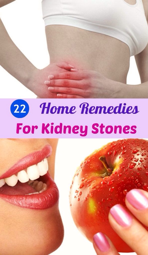 22 Home Remedies for Kidney Stones 👍👍👍 Musely