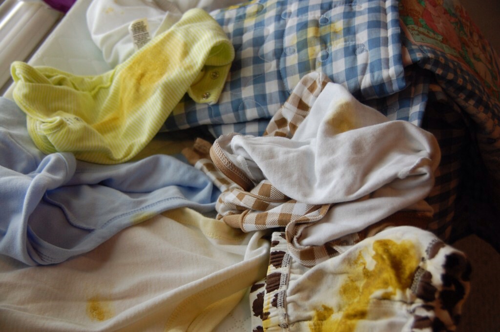 how-to-lighten-baby-poop-stains-on-clothes-musely