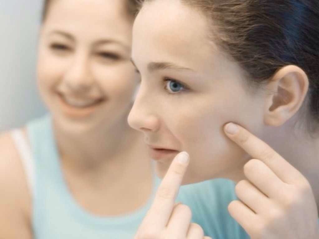 Прыщи на лице у женщины после 30 Прыщи на лице у женщины после 30