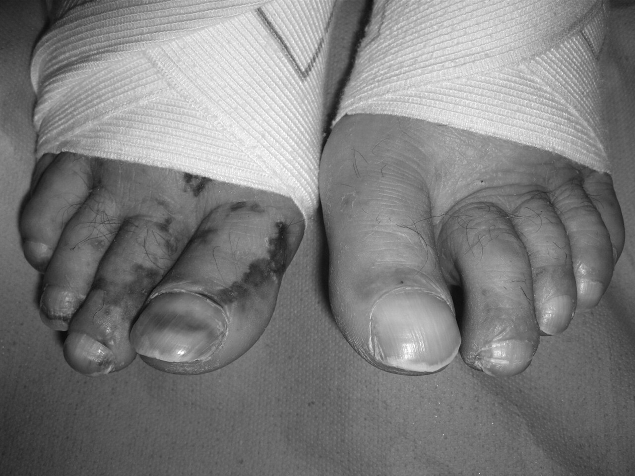 What Are Your Feet Trying To Tell You Musely what-are-your-feet-trying-to-tell-you-musely