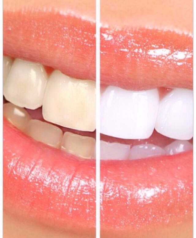 How To Get Whiter Skin Naturally In A Week How To Get Whiter Skin Naturally In A Week
