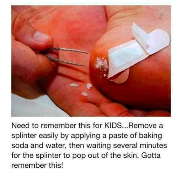 Easily Get A Splinter Out Musely