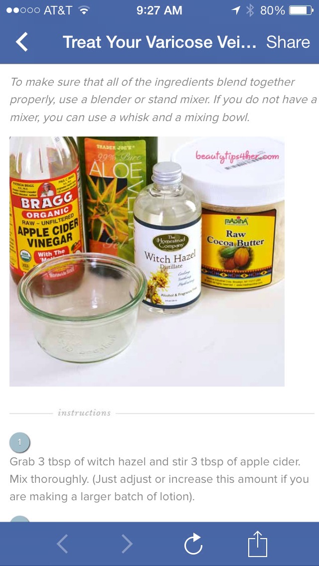 Treat Your Varicose Veins With a Homemade Lotion A Homemade Remedy