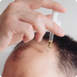 Receding Hairline