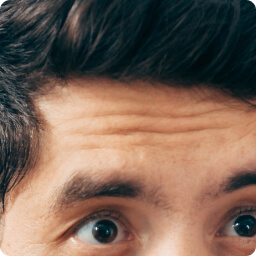Wrinkles