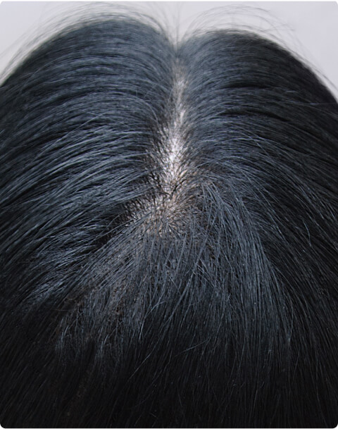 Hair Loss Product Reviews and Photos