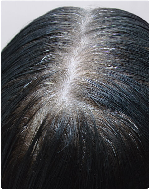 Hair Thinning Treatment - Real User Reviews