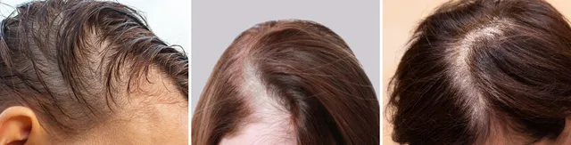 Aging Hair