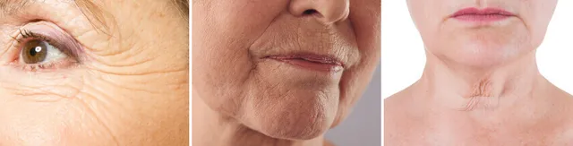 Anti-Aging