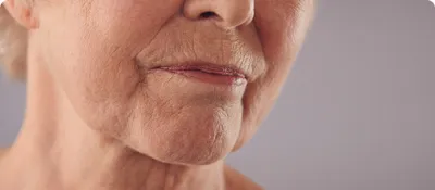 Musely Estrogen Facial Cream