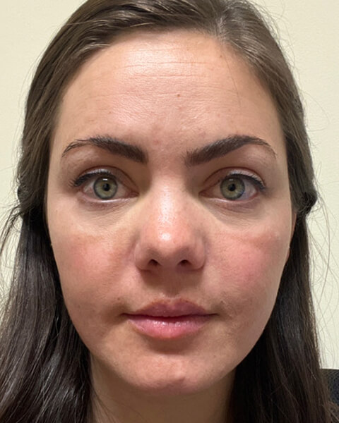 Abigail N. after treatment
