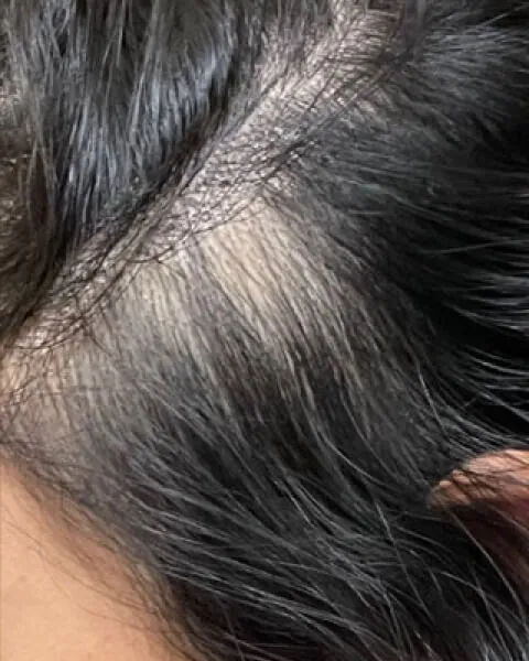 After