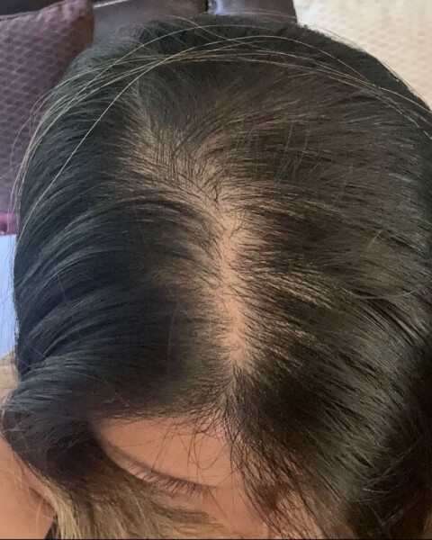 Cathleen T. after treatment