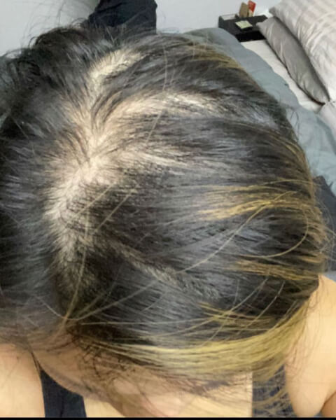 Cathleen T. before treatment