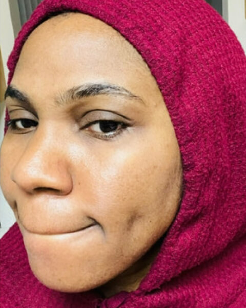 Chinyere N. after treatment