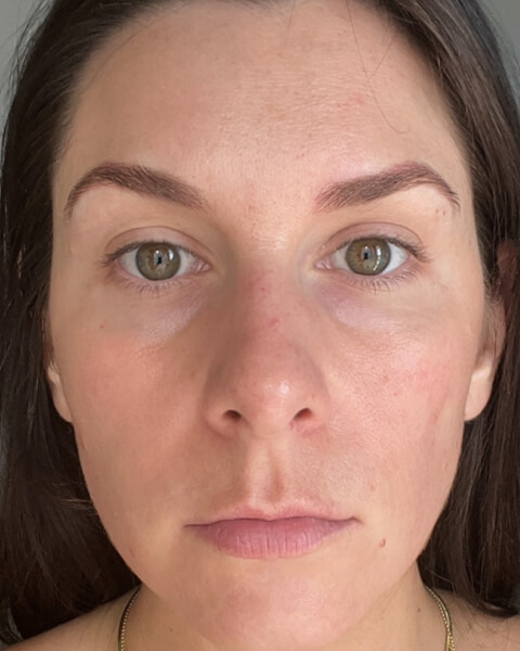 Danielle after treatment