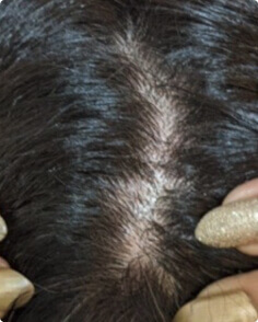 Dina A. after treatment