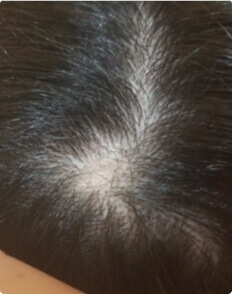 Dina A. before treatment