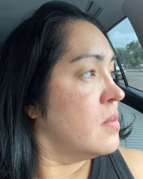 Gina H. after treatment