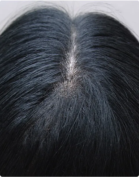 Hair Loss Product Reviews and Photos