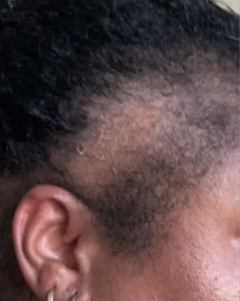 After
