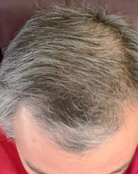 Jinshan L. after treatment