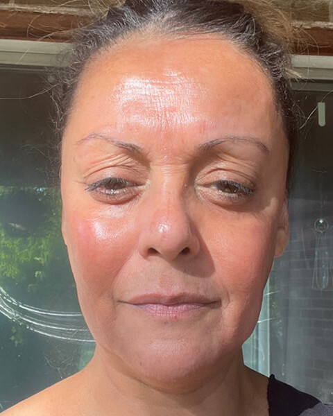 Jodi C. after treatment