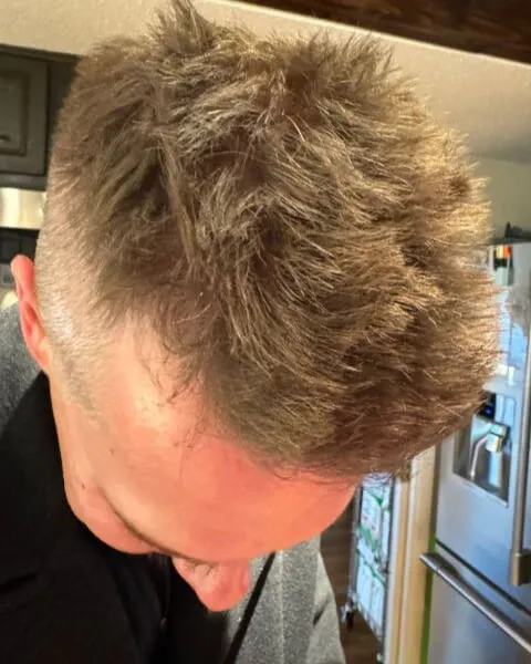 Hair Growth Products for Men - Customer Reviews