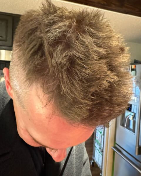 John H. after treatment