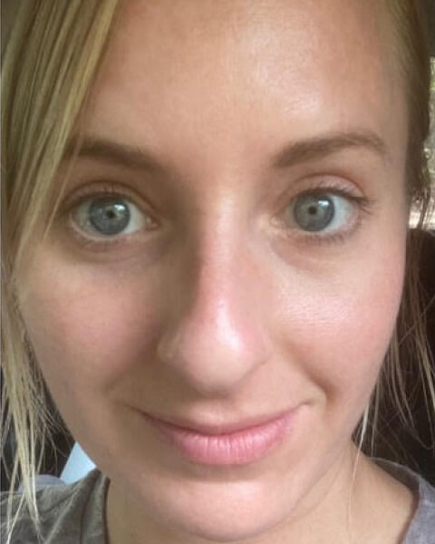 Katie A. after treatment