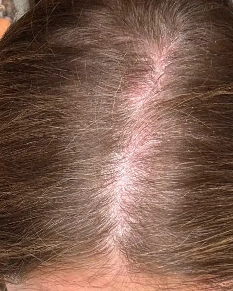 After
