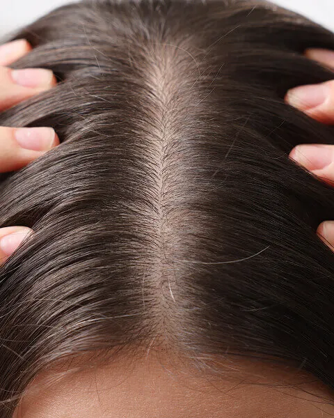 Clinically Proven Hair Growth - Real Stories & Pics