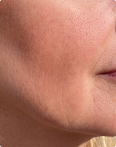 Marcy T. after treatment