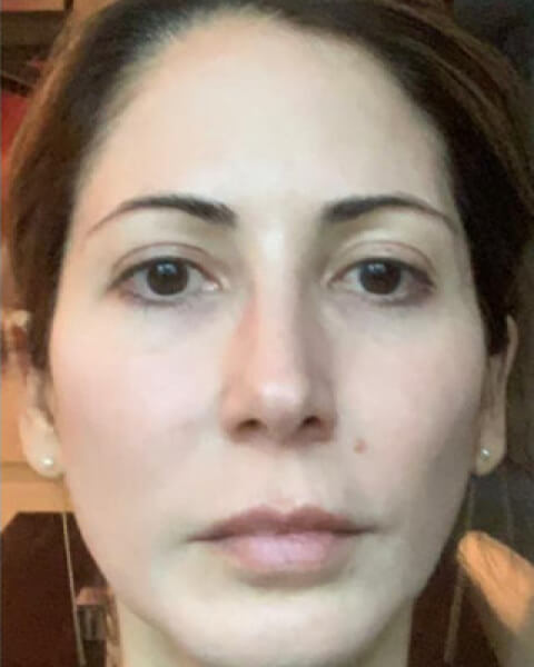 Maria P. after treatment