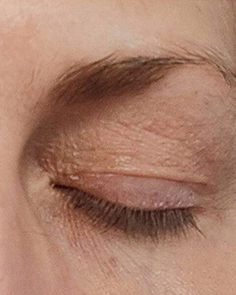 Melissa P. after treatment