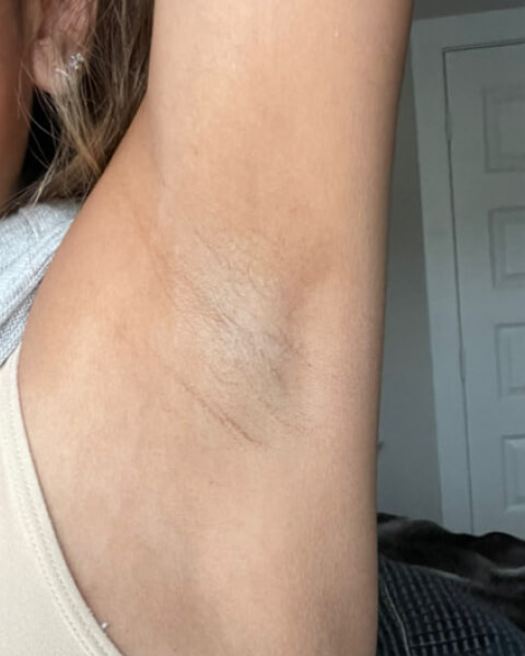 Nancy Z. after treatment