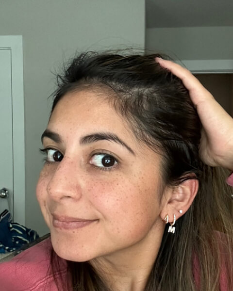 Nancy Z. after treatment