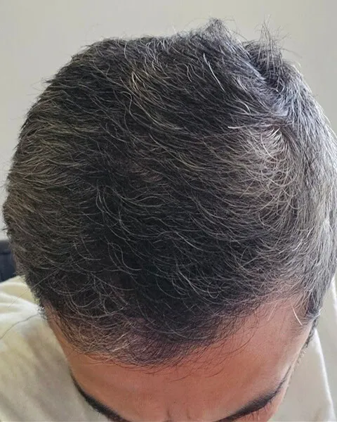 After