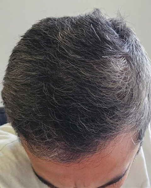 Saif T. after treatment