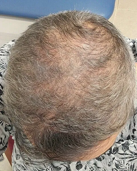 Before