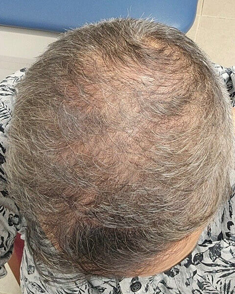 Saif T. before treatment