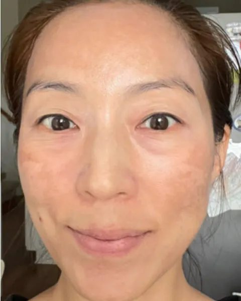After