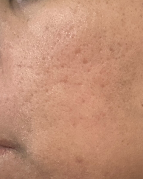 Sudipta B. before treatment