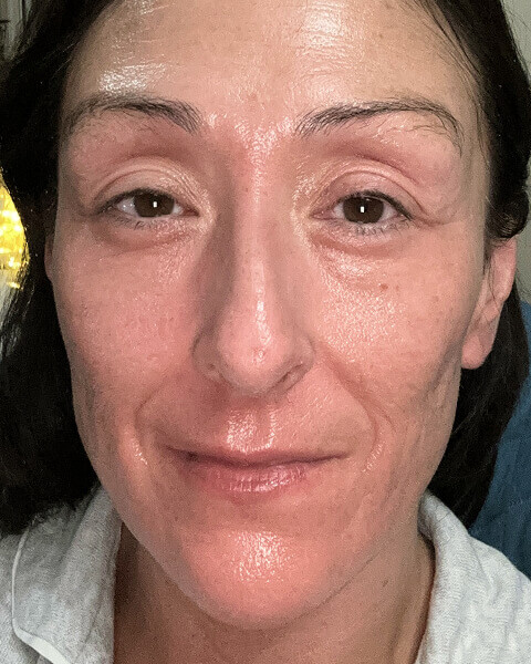 Tanya S. after treatment