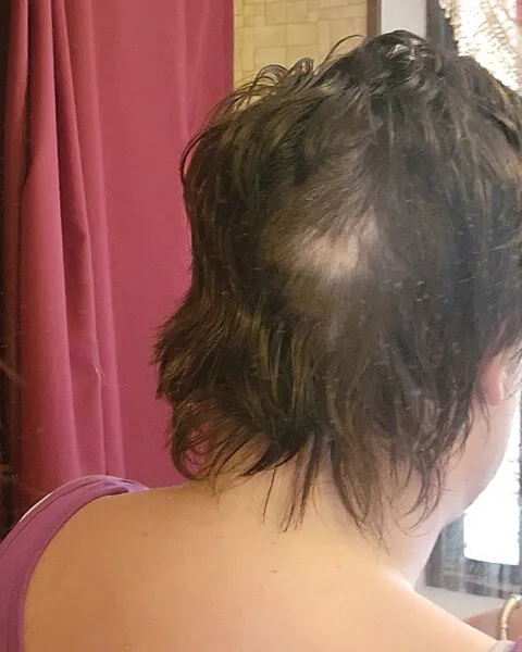 Before
