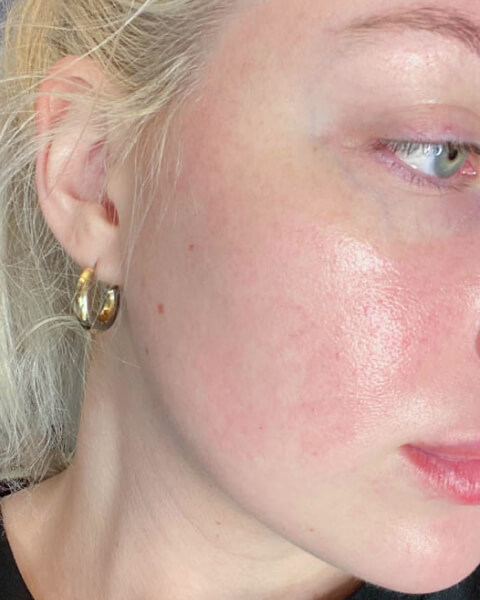 Taylor-Nicole L. after treatment