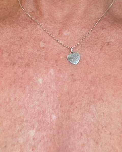 Tracy P. after treatment