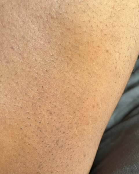 Zammy after treatment