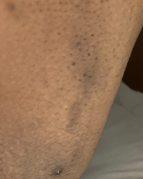 Zammy before treatment