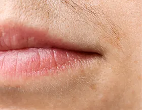 Facial Hair